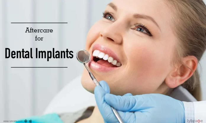 The Journey to a New Smile: From Consultation to Aftercare for Teeth Implants