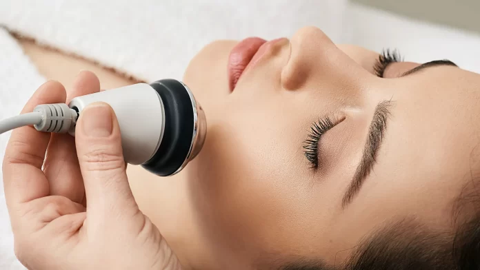 Radio Frequency Skin Tightening: Treatment Areas and Benefits